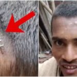 सिर के घाव पर टांकों की जगह स्टेपलर से लगाया पिन, नवादा में ‘ग्रामीण डॉक्टर’ की लापरवाही से मचा हड़कंप