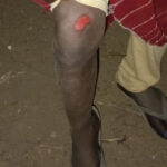 असनी में काल बन चुके ब्रेकर से हादसा: बाइक सवार गिरे, संगठन ने पहुंचाया अस्पताल