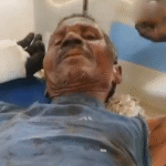 भालू के हमले से ग्रामीण गंभीर घायल, इलाके में दहशत