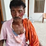 बंधौरा में युवक पर हमले का मामला दर्ज